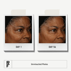 Rodan + Fields ReDefine clay cleanser texture closeup highlights pore refinement.