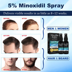 Rosever minoxidil hair growth on scalp visual suggesting potential growth.