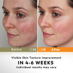Rvlaim turmeric kojic cleansing pads patch-test scene for sensitive skin