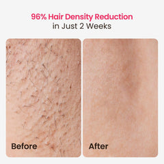 SALLOOT full-body auto-glide mode delivers fast at-home treatments
