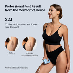 SALLOOT Nova P5 dual pulses technology targets follicles for smoother skin.