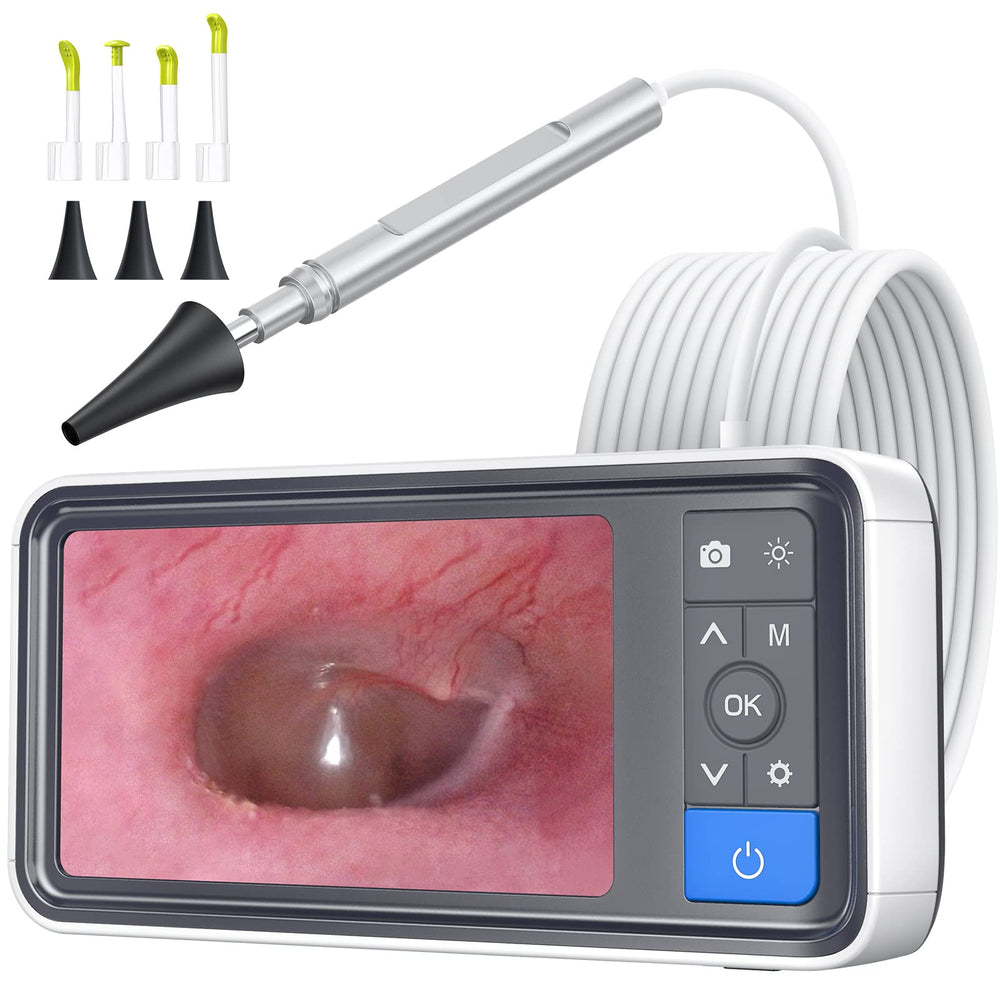 ScopeAround otoscope ear camera with IPS screen for clear at-home ear checks