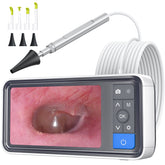 ScopeAround otoscope ear camera with IPS screen for clear at-home ear checks