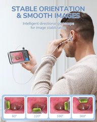 ScopeAround otoscope six LED lights with adjustable brightness for detail