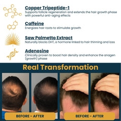 Seraphime copper peptide serum caffeine ingredient highlighted for energizing scalp health