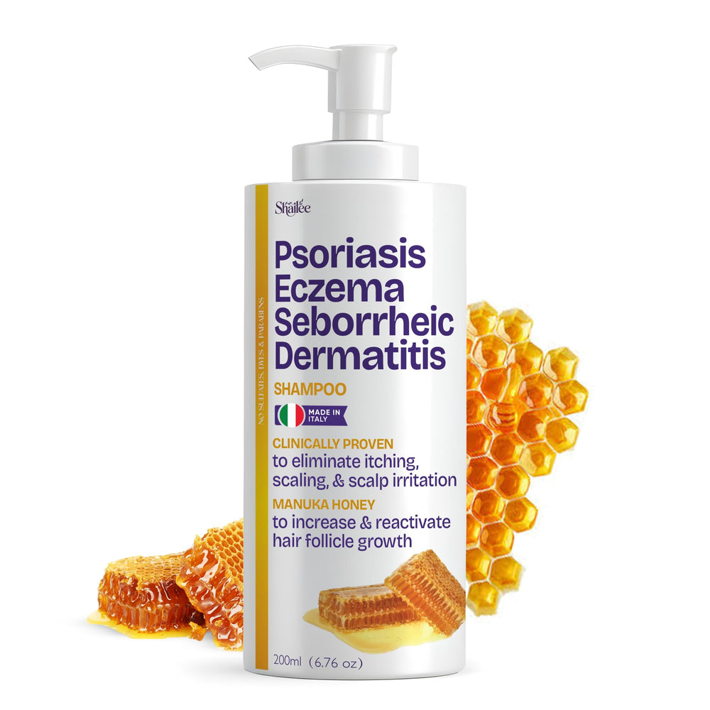 Shailee psoriasis shampoo bottle closeup highlighting calming formula for itchy scalp relief.
