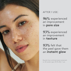 SHANI DARDEN Triple Acid Peel solution-application demonstrates quick exfoliation and smoother texture.