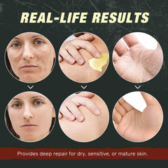 Shuangjia frankincense castor oil balm application demonstrating quick absorption.