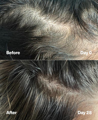 SickScience PowerCycle exosome serum being massaged into the scalp for density support