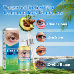sinBron eyelid drops close-up illustrates gentle application and redness reduction potential