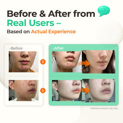 SINSURU Watery Sulfur 82 applying serum on face during routine.