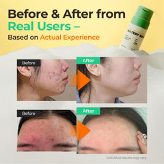 SINSURU Watery Sulfur Pore Cleansing Powder pour shows powder-to-foam action.