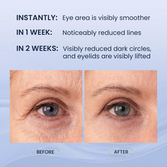 SKIN ULTIMA Dual Eye Cream upper-eye application demonstrates eyelid lifting effect.