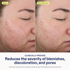 Skinfix 2% BHA Cleanser foamy lather—helps clear pores and oil buildup.