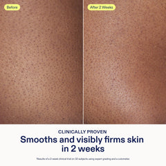 Skinfix AHA/BHA Renewing Body Cream glow closeup demonstrates luminous, even-toned skin.