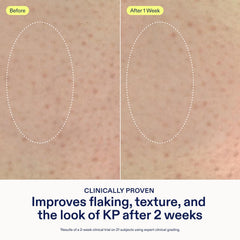 Skinfix smoothing cream emollients squalane and glycerin showcase deep hydration.