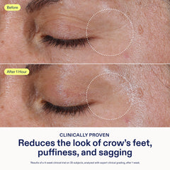 Skinfix Triple Lipid Eye Treatment tube cap close-up highlighting fragrance-free formula.