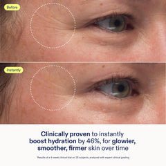 Spread-on Skinfix cream on skin shows dewiness and lightweight moisturization