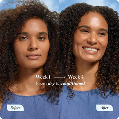 Sky Organics castor oil drops on skin illustrating hydration and daily skincare