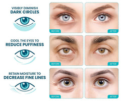 Stylia puffy eyes depuffing effect close-up after use