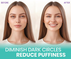 Stylia under-eye patches dark circles closeup brighten and refresh delicate skin