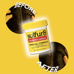 Sulfur8 bottle with hair close-up showing dandruff control and comfort on the scalp.