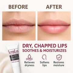 Three-pack Superlan lanolin lip balm for family lip care in one package.