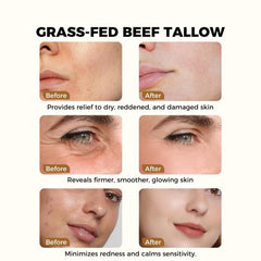 SURORAIN Tallow Honey Lip Balm delivers concentrated moisture for dry lips.