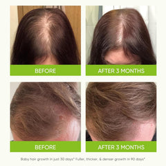 Svvimer Fragrance-free label emphasizes gentle formulas for sensitive scalps.