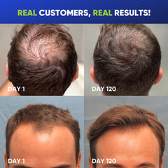 Svvimer Rosemary Tea Tree Oil ingredients panel emphasizes refreshing scalp notes.