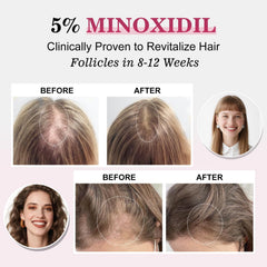 TAGOQHIA woman applying minoxidil spray demonstrates daily scalp treatment for regrowth potential.