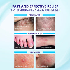 TAGRID Folliculitis Cream closeup texture highlights non greasy fast absorbing finish.