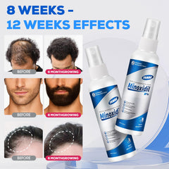TEADZ Minoxidil ingredients castor aloe rosemary biotin nourishes follicles