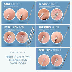 Teenitor stainless steel acne tools for durable, easy sterilization and safe skin care