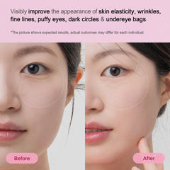 TEREZ & HONOR under-eye patches shown for morning use to refresh tired eyes.