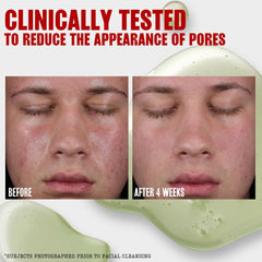 Green Kaolin Clay image highlights pore refining and balance for oily skin