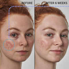 The INKEY List serum texture on skin reveals quick absorption.
