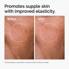 The Ordinary Hyaluronic Acid 2% + B5 serum being applied on skin for hydration