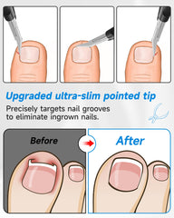 Tisojpod All-in-One Nail Trimmer trims nails, hangnails, and more.