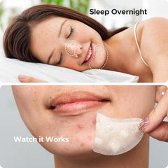 TKTK chin-patch-hydrocolloid-closeup-technology highlights skin-friendly absorption