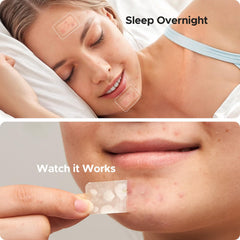 TKTK hydrocolloid-absorption-boost patch on skin demonstrates stronger absorption