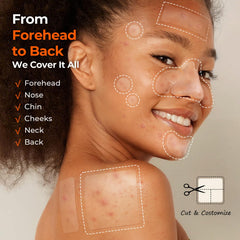 TKTK Pimple Patches large back and cheek patches for bigger breakouts.