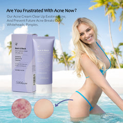 Tobcharm back acne treatment cream on the back promotes smoother, clearer skin.