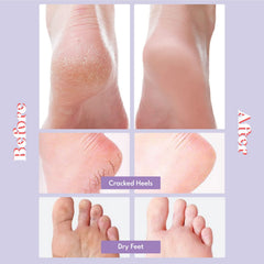 TOI:L extra silky foot mask pairs ready for pampering sessions at home.