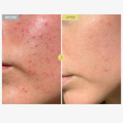 TOSOWOONG Black Snail Mucin 92% cream application routine suggests smooth skin prep.