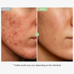 TOSOWOONG Exosome CICA Face Cream swirl on hand for quick absorption and soothing feel
