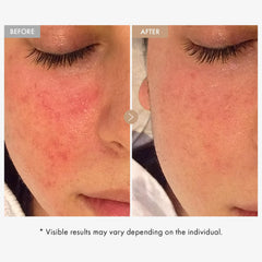 TOSOWOONG Real Oatmeal Relief Cream texture swirls for a non-greasy finish