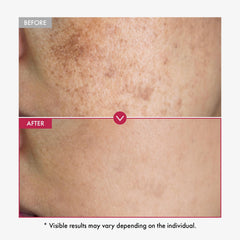 TOSOWOONG lightweight, pink-toned serum texture demonstrated for quick absorption and non-greasy feel.