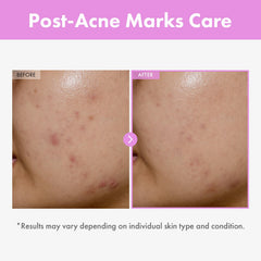 TOSOWOONG serum texture shown as toner-like for fast absorption.
