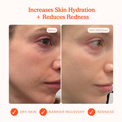 Tower 28 SOS cream application close-up for redness relief and soothing care.